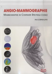 ANGIO-MAMMOGRAPHIE MED-LINE