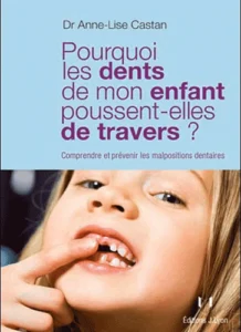 Pourquoi les dents de mon enfant poussent-elles de travers ? - Comprendre et prévenir les malpositions dentaires